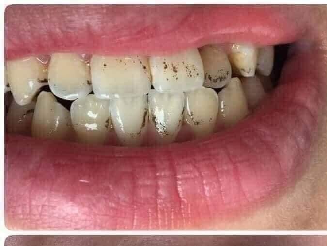 Gói dùng thử bột đánh trắng răng 100gam