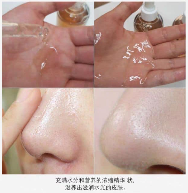 Tinh chất dưỡng da MEDI-PEEL Pore 9 Tightening Serum 50ml