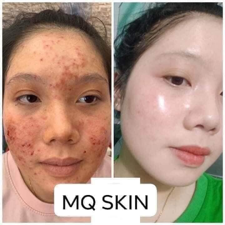 Serum Tái Tạo Da Nhân Sâm MQ SKIN 80ml