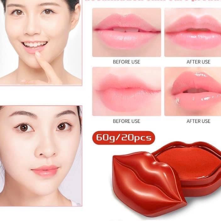 Nạ môi ZOZU 20 miếng