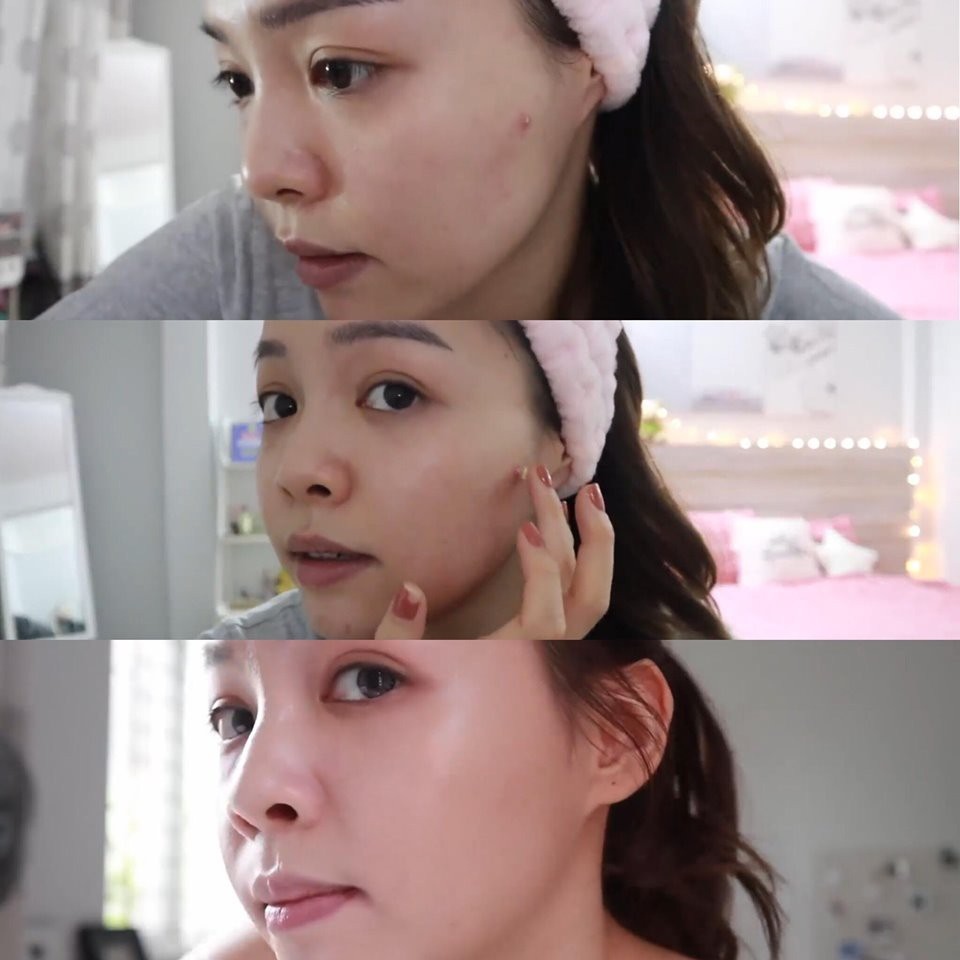 ♟ Chấm mụn Eucerin Pro Acne Solution A.I Clearing Treatment