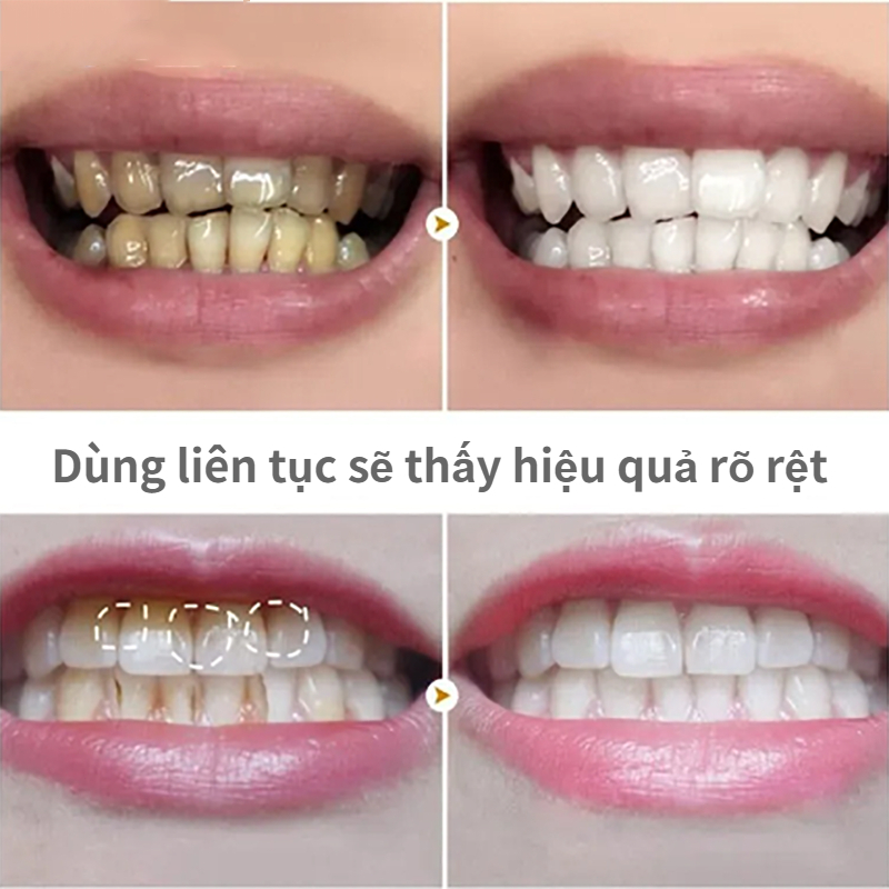 Bột Đánh Răng  Toothpowder tẩy trắng và làm sạch răng 50g [NHẬP KHẨU CHÍNH HÃNG 100%]