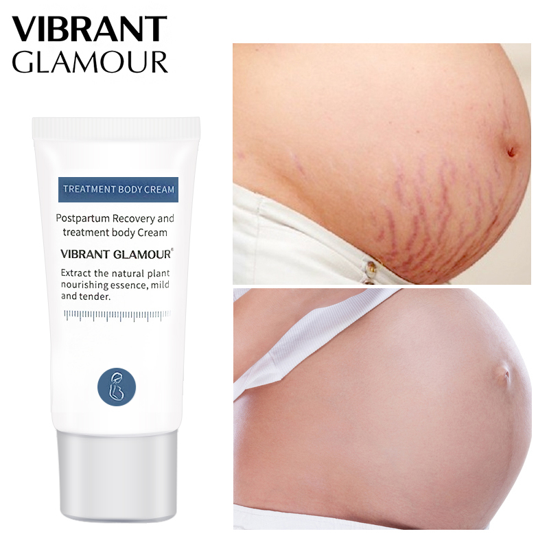 VIBRANT GLAMOUR Stretch Marks Remover Cream improve relaxationdull Anti Winkles Firming BodyCare giá rẻ