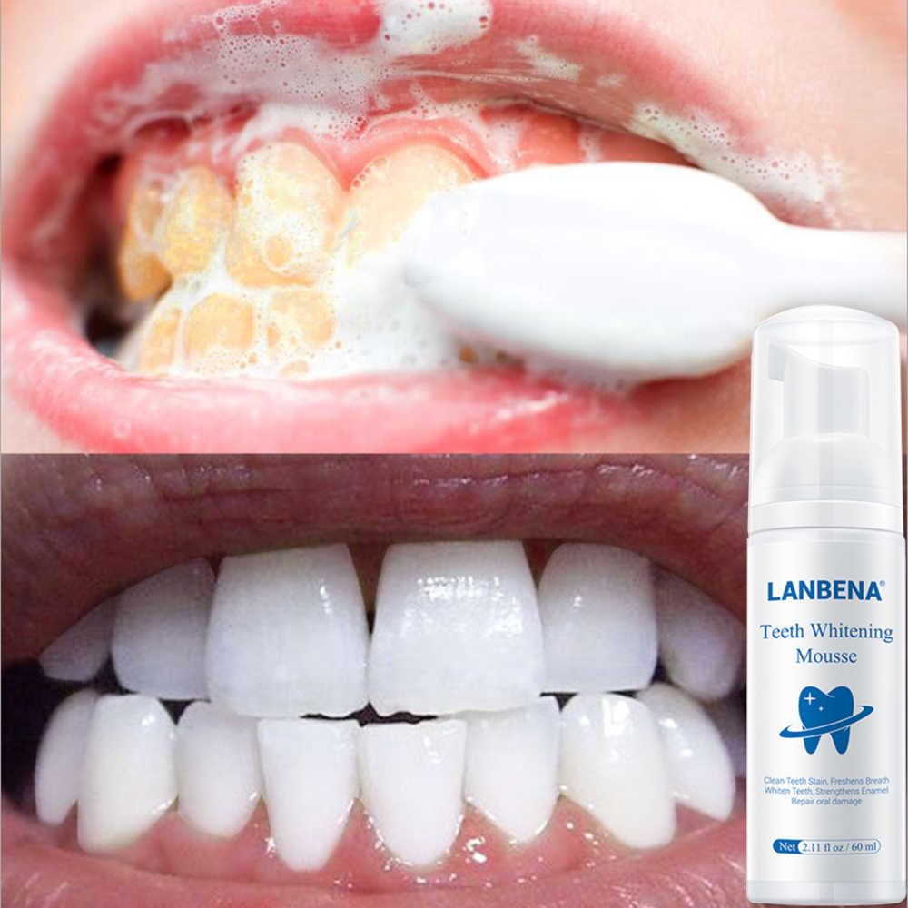[HCM]Serum Làm Trắng Răng Tẩy Ố Vàng LANBENA