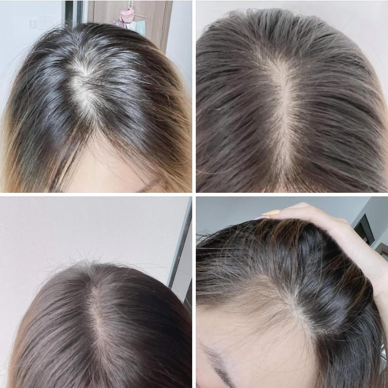 Xịt Mọc Tóc MINOXIDIL BAILLEUL 2% 5% - NGĂN RỤNG TÓC, KÍCH THÍCH MỌC TÓC