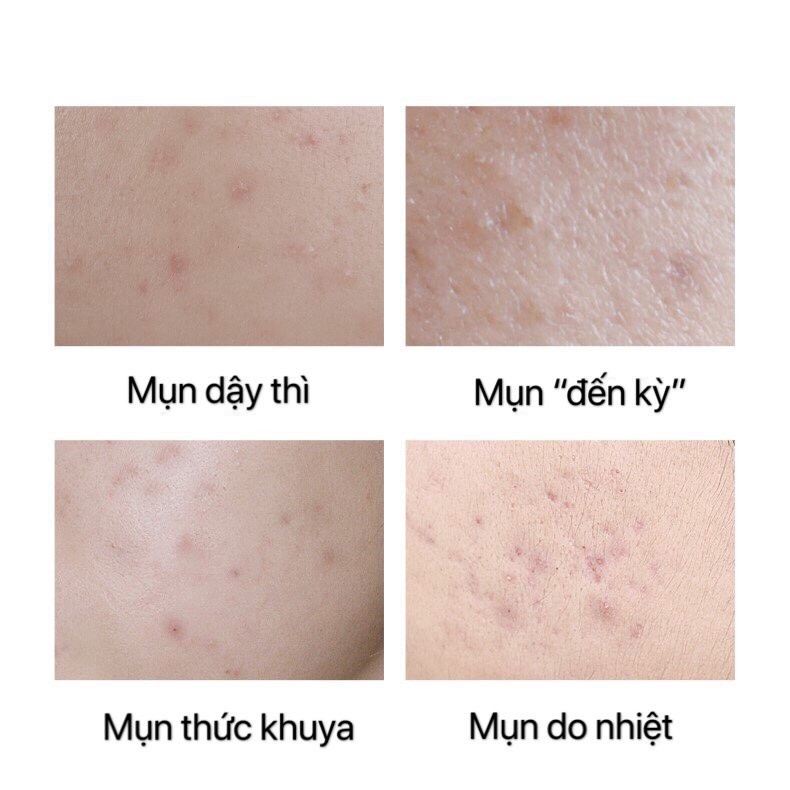 [LUCENBASE] Tinh chất Oligopeptide Essence dịu da mờ thâm mụn phục hồi mịn da 30ml