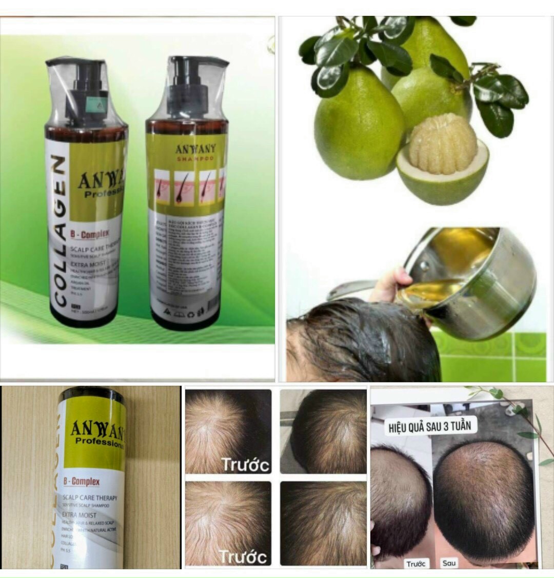 Dầu gội kích thích mọc tóc Anwany Collagen 500ml- tinh dầu bưởi