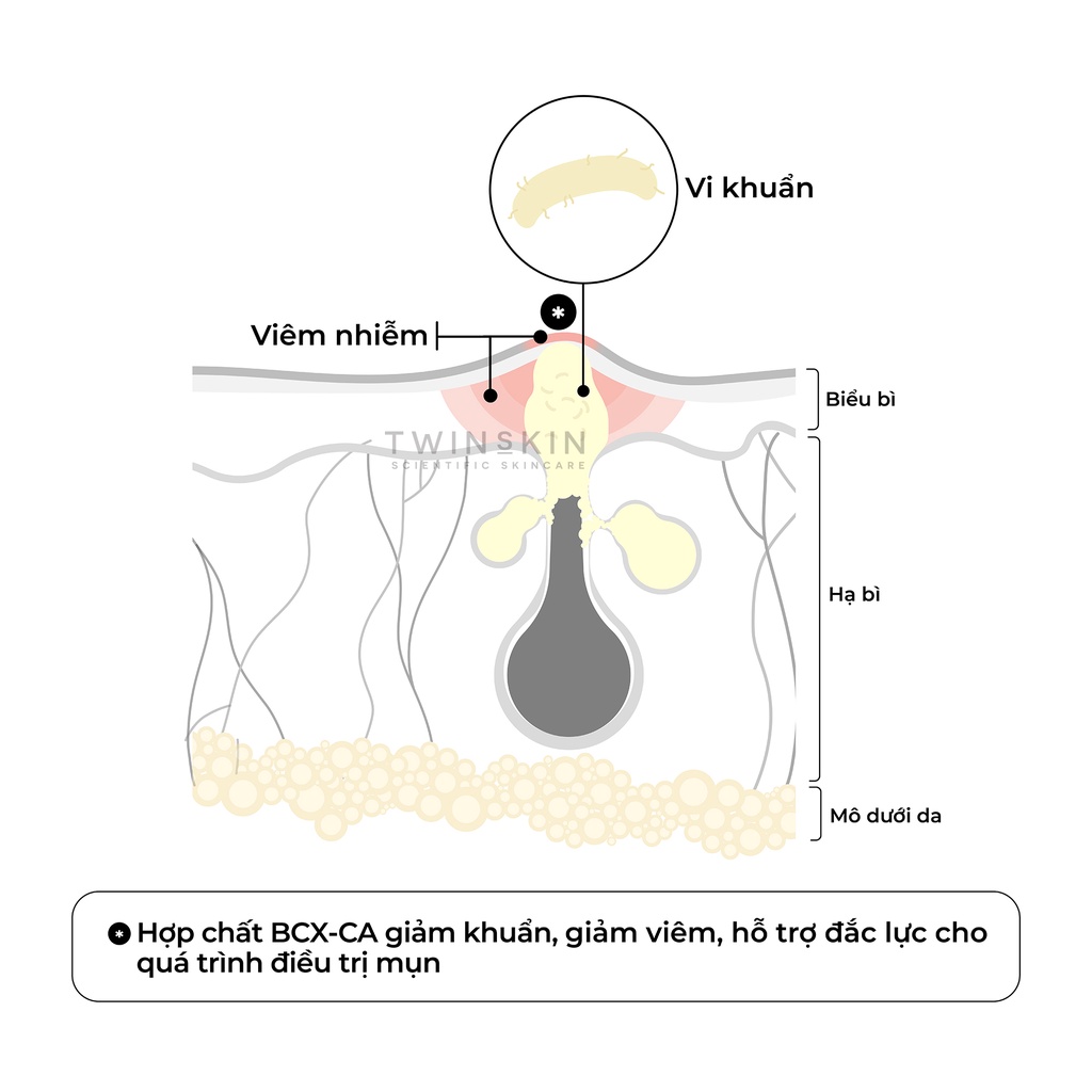 [HCM]Dung Dịch Làm Sạch Kép Cho Da Mụn - Acne Cleansing Water Fullsize