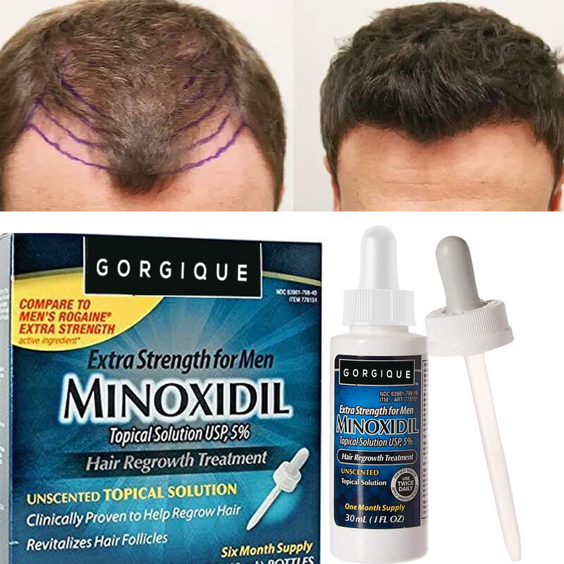 Minoxidill 5% - Kích Thích Mọc Tóc - Vitamin Trị Rụng Tóc