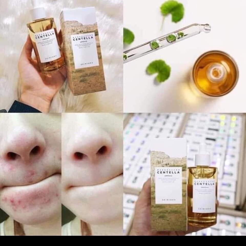 Serum Rau Má Giảm Mụn Centella 100ml