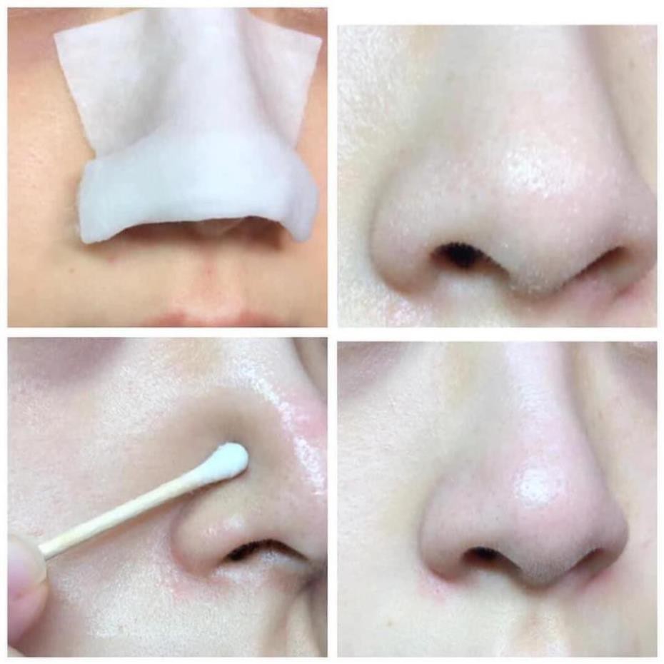 Dung Dịch Ủ Mụn MediPeel Extra Super 9