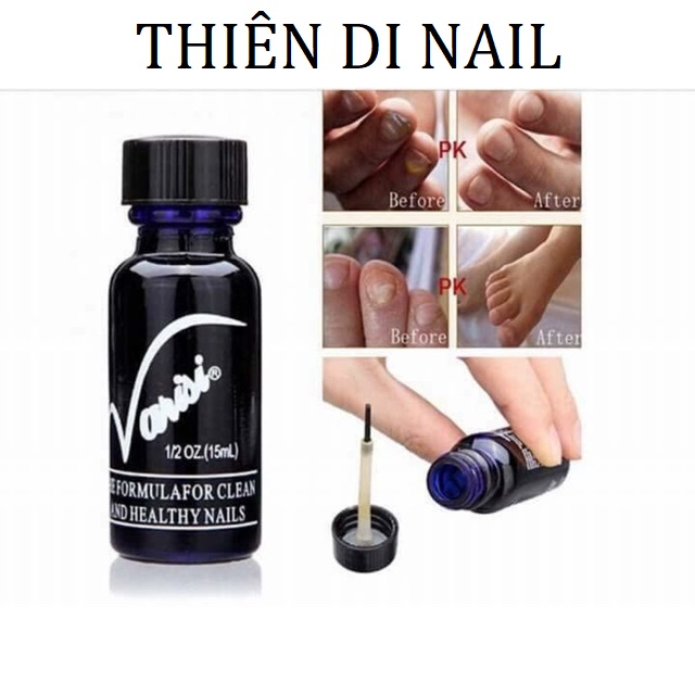 Dung dịch chống nấm móng - hại móng -phục hồi móng hư tổn