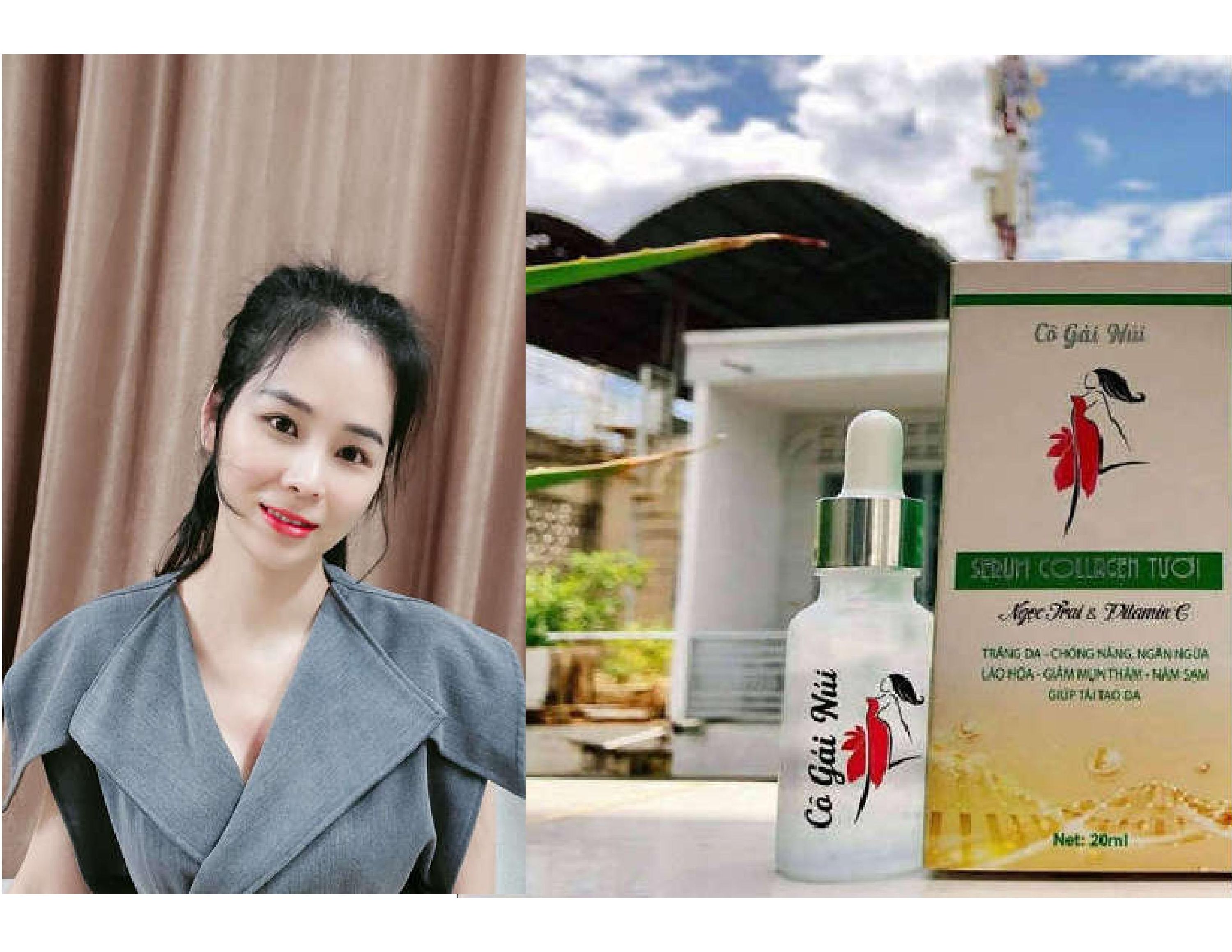 Serum collagen