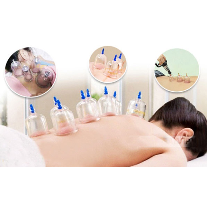 Bộ Giác Hơi 12 Ống Không Dùng Lửa
