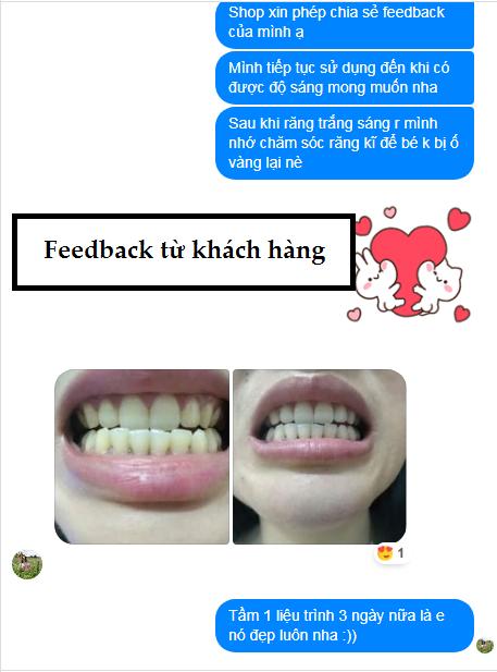 [Miếng lẻ] Miếng Dán Trắng Răng Anriea Black Tooth Whitening - 30 Minutes Express