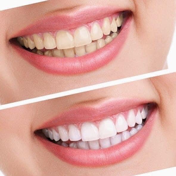 KEM ĐÁNH TRẮNG RĂNG SIÊU THÍCH CREST 3D WHITE 158GR CỦA MỸ