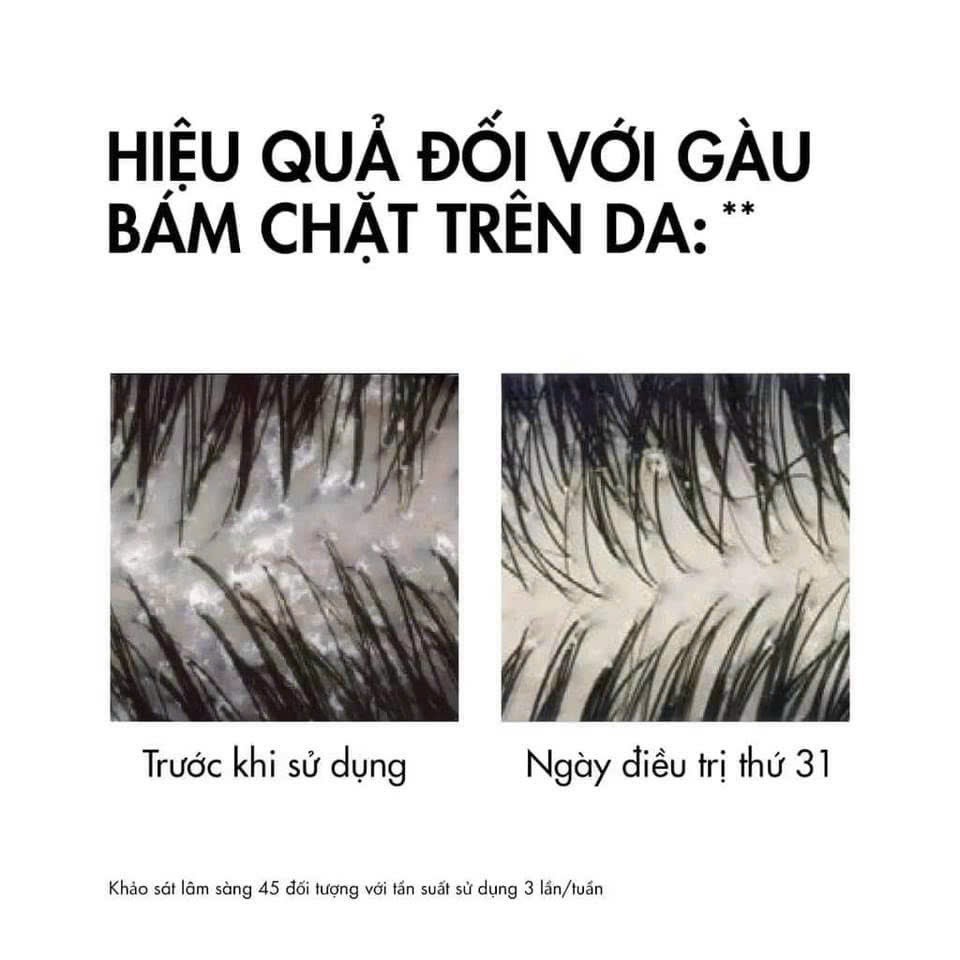 DẦU GỘI TRỊ GÀU VICHY DERCOS