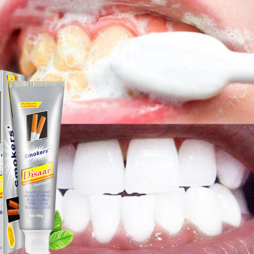 Kem Đánh Răng Tẩy Ố Vàng Trắng Răng Thái Lan Disaar