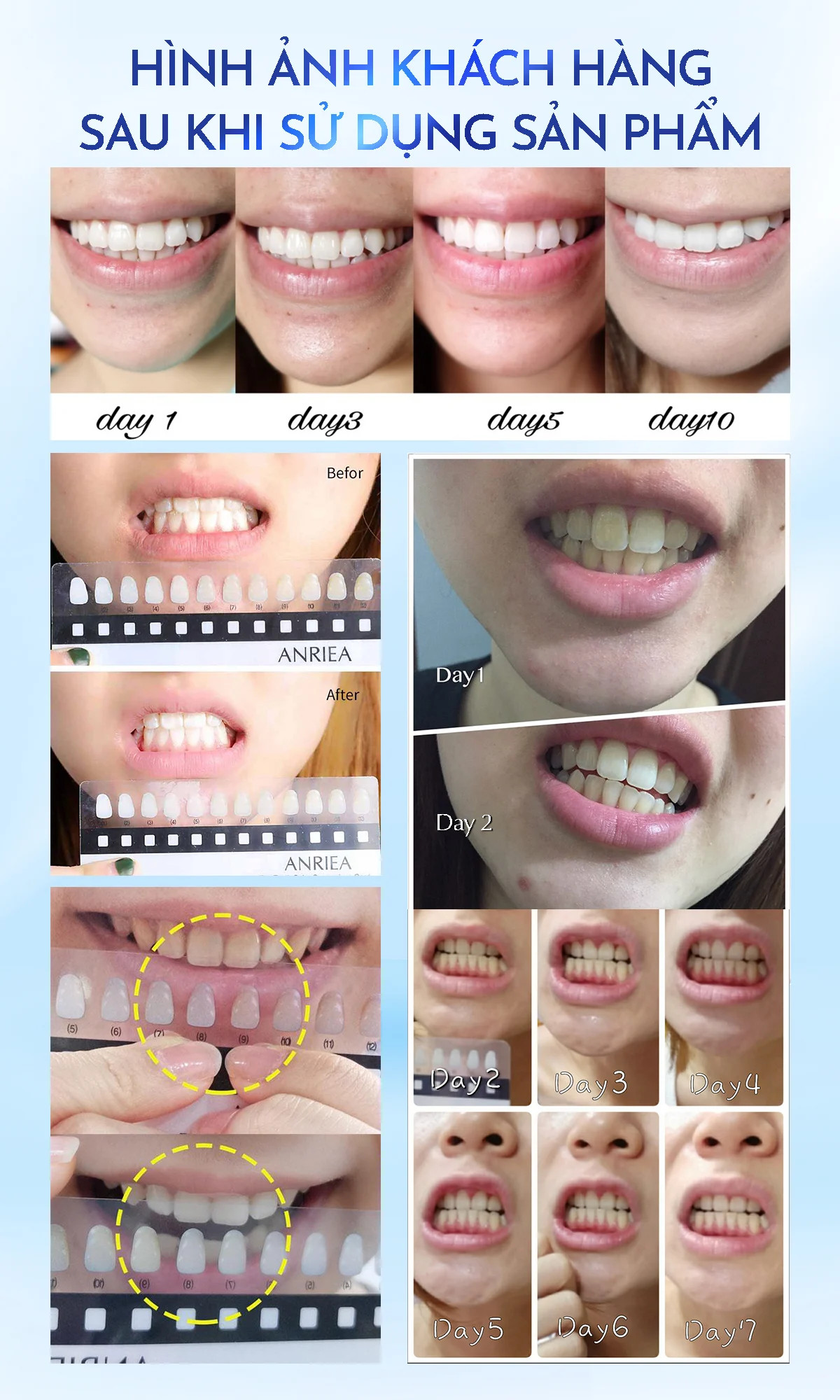 💖Miếng dán trắng răng Anriea - Miếng lẻ dùng thử