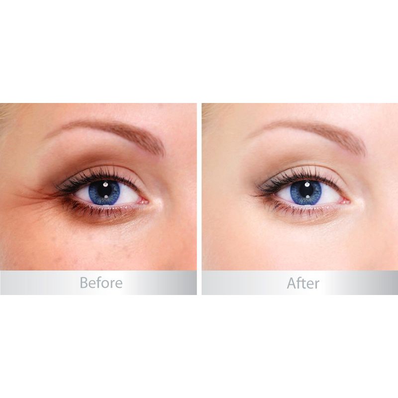 Serum Dưỡng Mắt Is Clinical Eye Complex