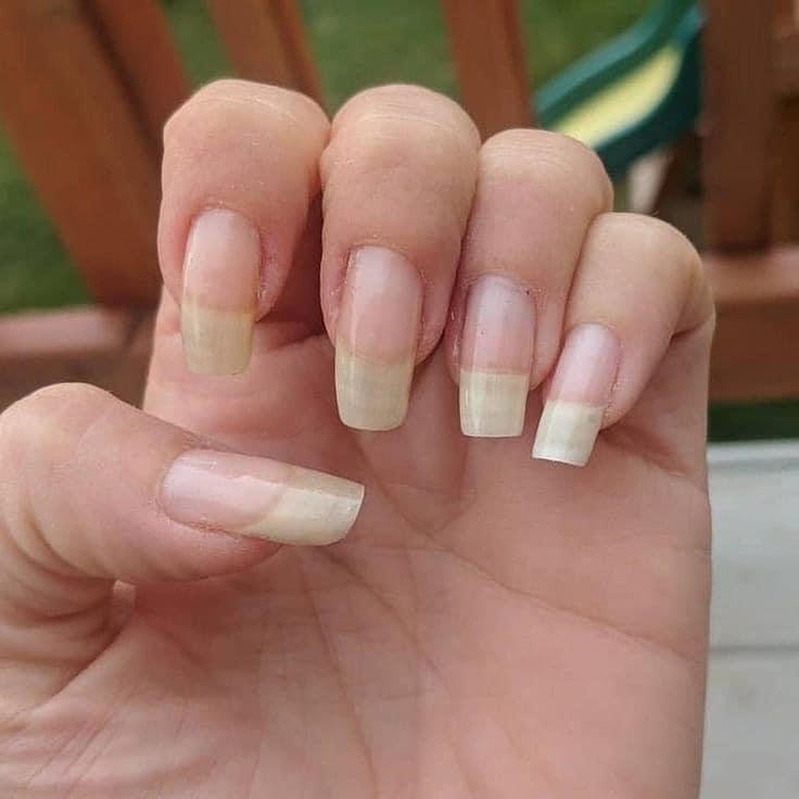 Dưỡng móng Độc Quyền - dưỡng dài móng, giúp móng chắc khỏe