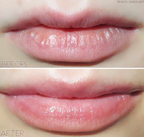 Son Dưỡng Môi Vaseline Lip Therapy Dạng Thỏi 4.8G