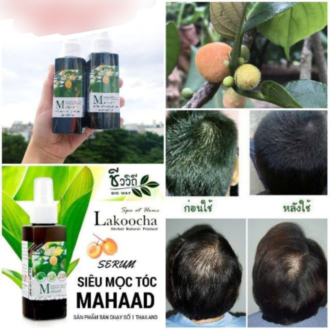 Xịt Kích Thích Mọc Tóc MAHAAD 120ml Thái Lan