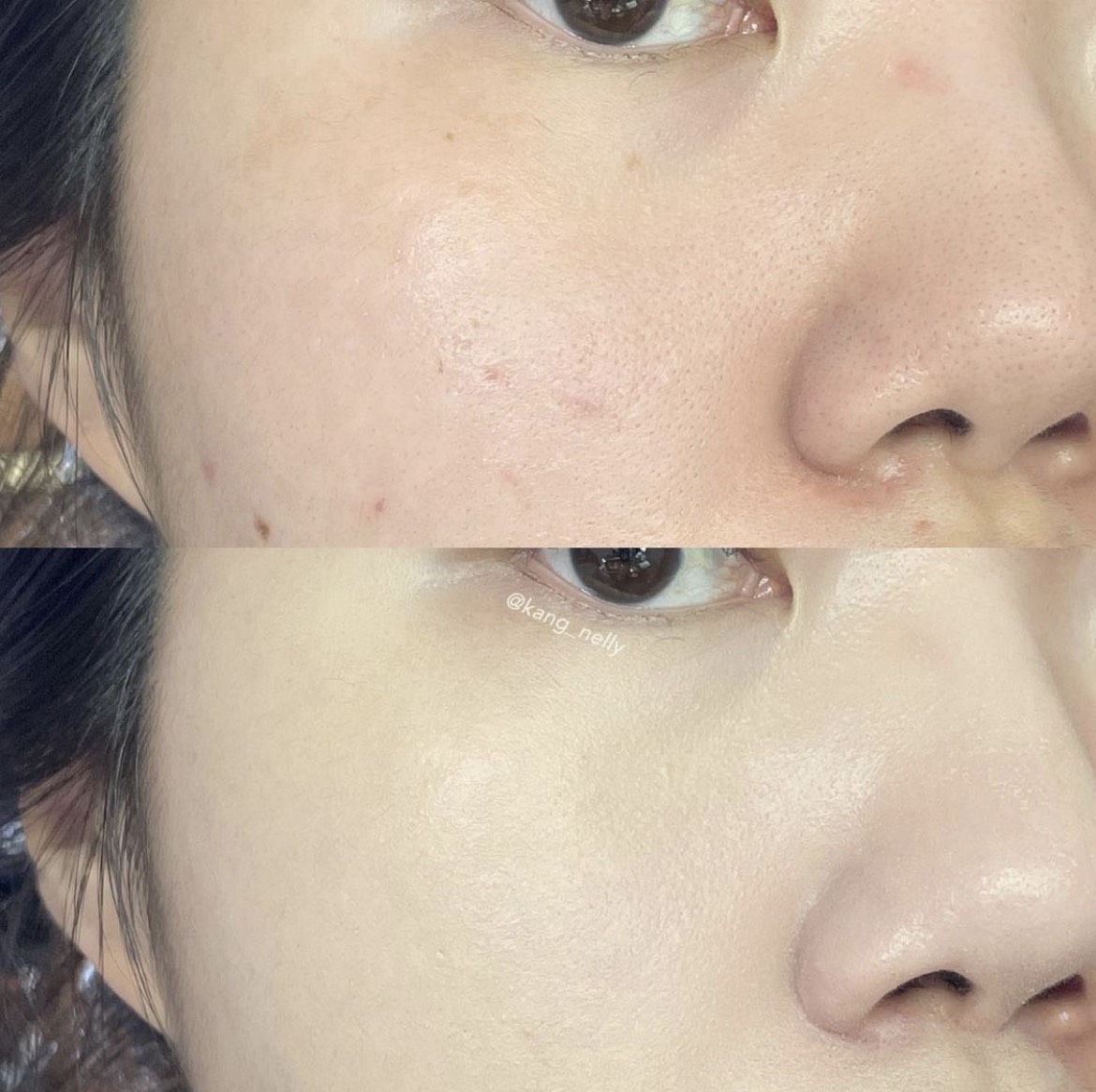 [MOONSHOT] Phấn nước Moonshot Micro Calming Fit