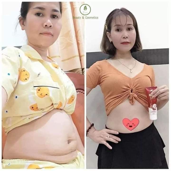 (1 tan mỡ olic tặng 1 đai)Tan Mỡ Olic