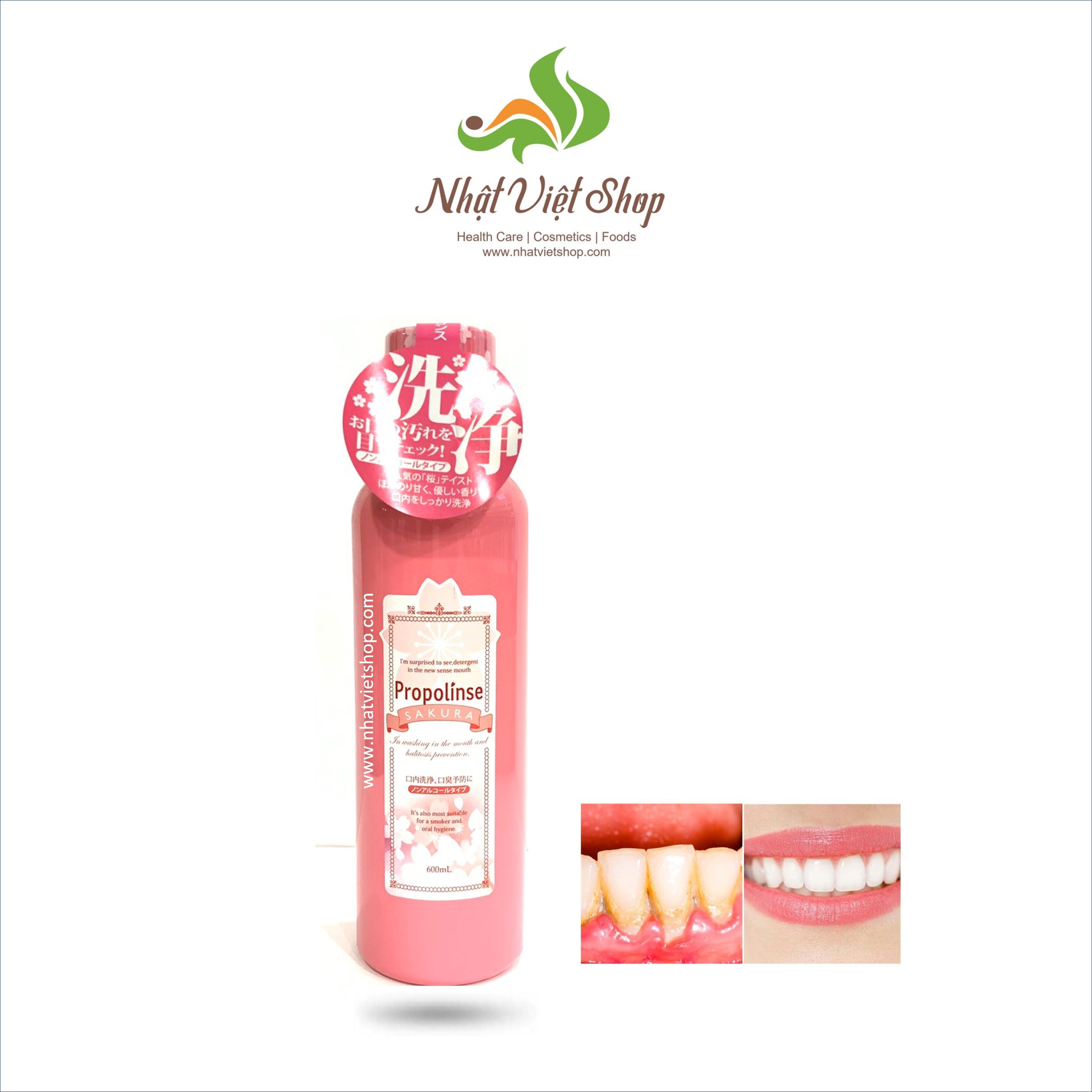 Nước xúc miệng Nhật Bản Propolinse 600ml