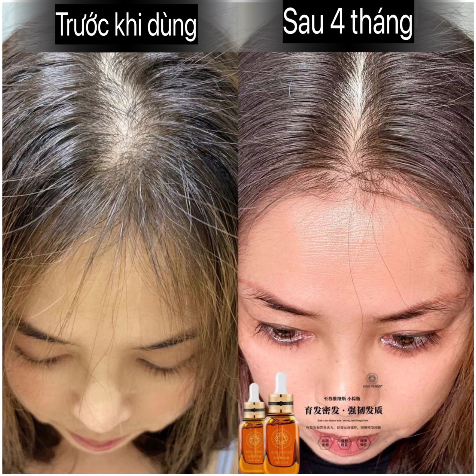 [Chính hãng] Combo Siêu Tiết Kiệm KING VENUS [Serum kích mọc tóc zzVENUS + Dưỡng mi KING VENUS (zz VENUS)]