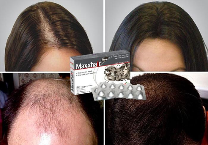 Maxxhair