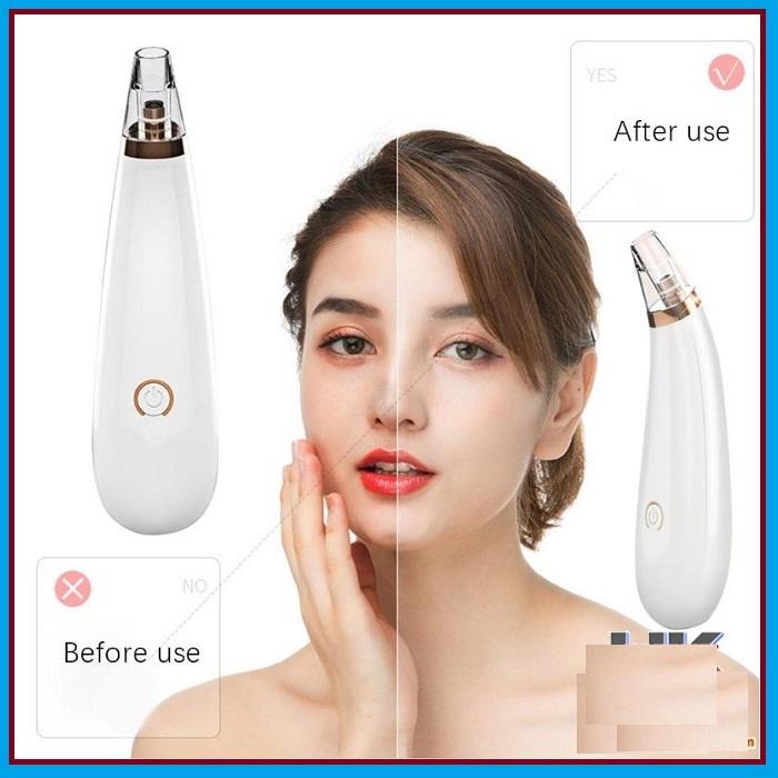 Máy hút mụn đầu đen 3 đầu BLACK HEAD DETECTOR
