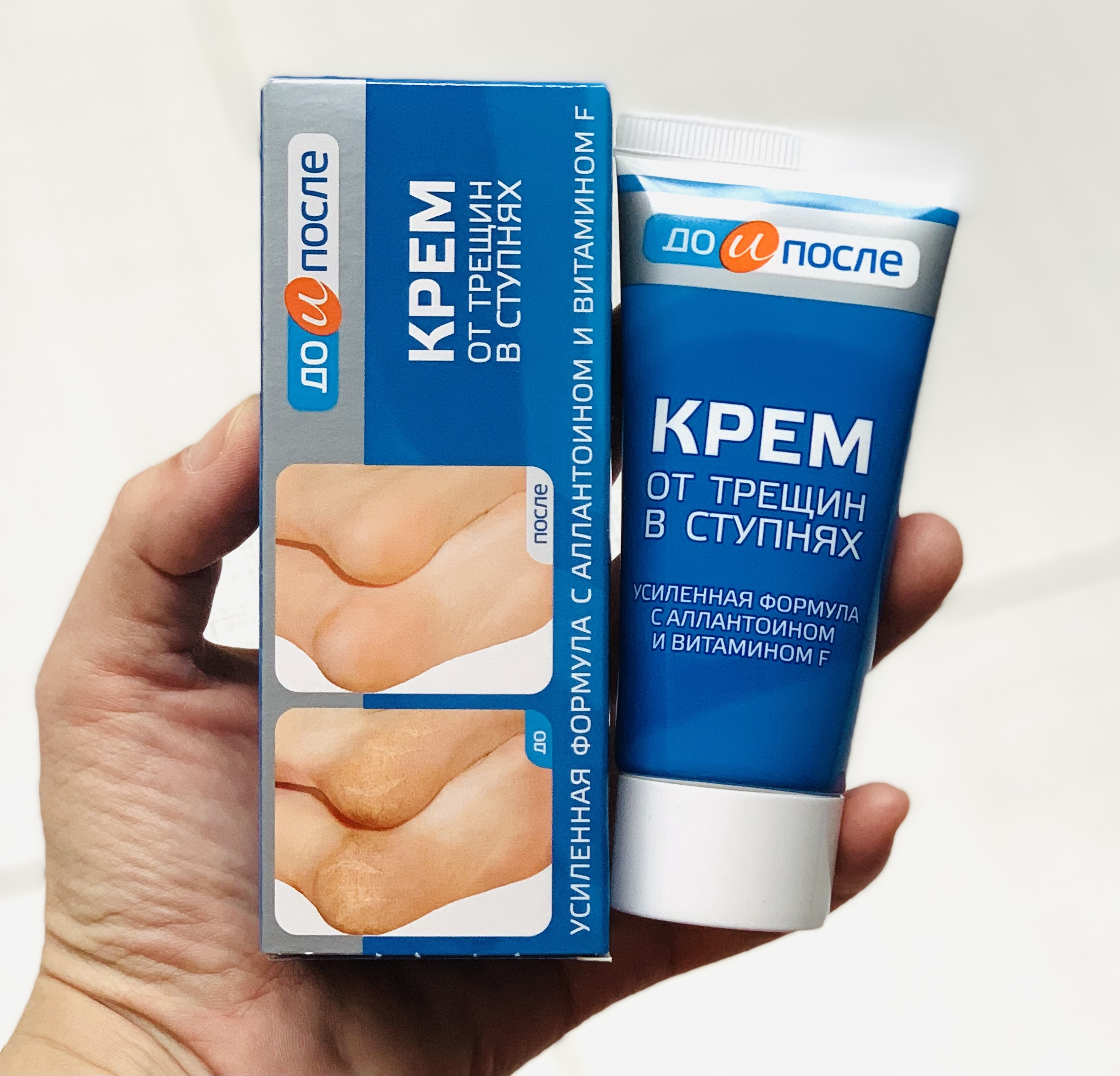 Tuýp kem thoa giảm nứt gót chân kpem - hàng nga - 50ml