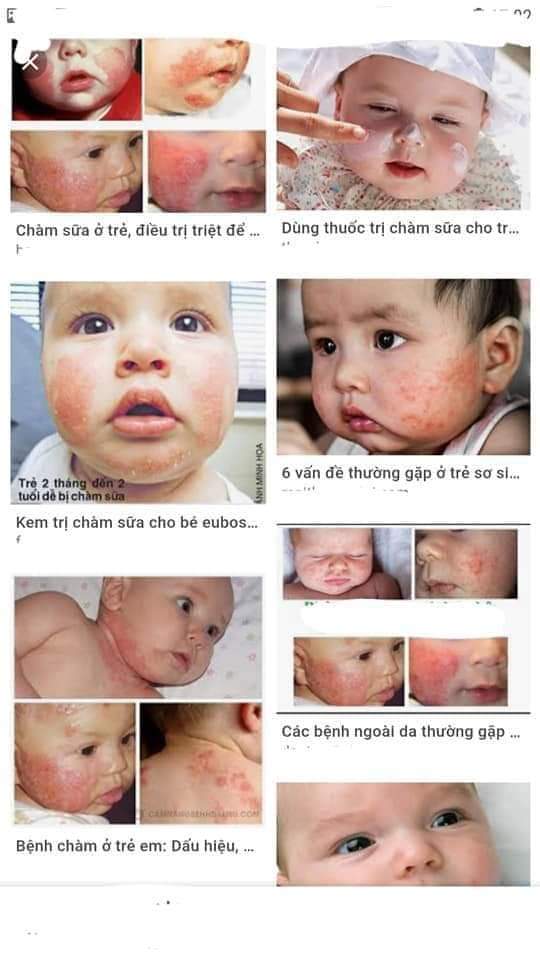 DƯỠNG DA TRẦN KIM HUYỀN - 0183