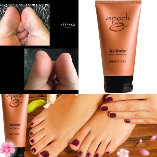 Kem nứt gót chân Epoch® Sole Solution® Foot Treatment