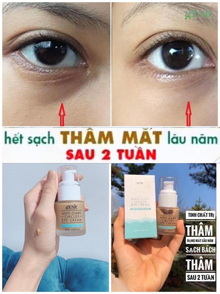 KEM TRỊ THÂM MẮT GENIE 20ml