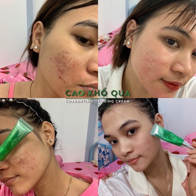 Cao Khổ Qua soHERBs Dành Cho Da Mụn Trắng Da 10ml
