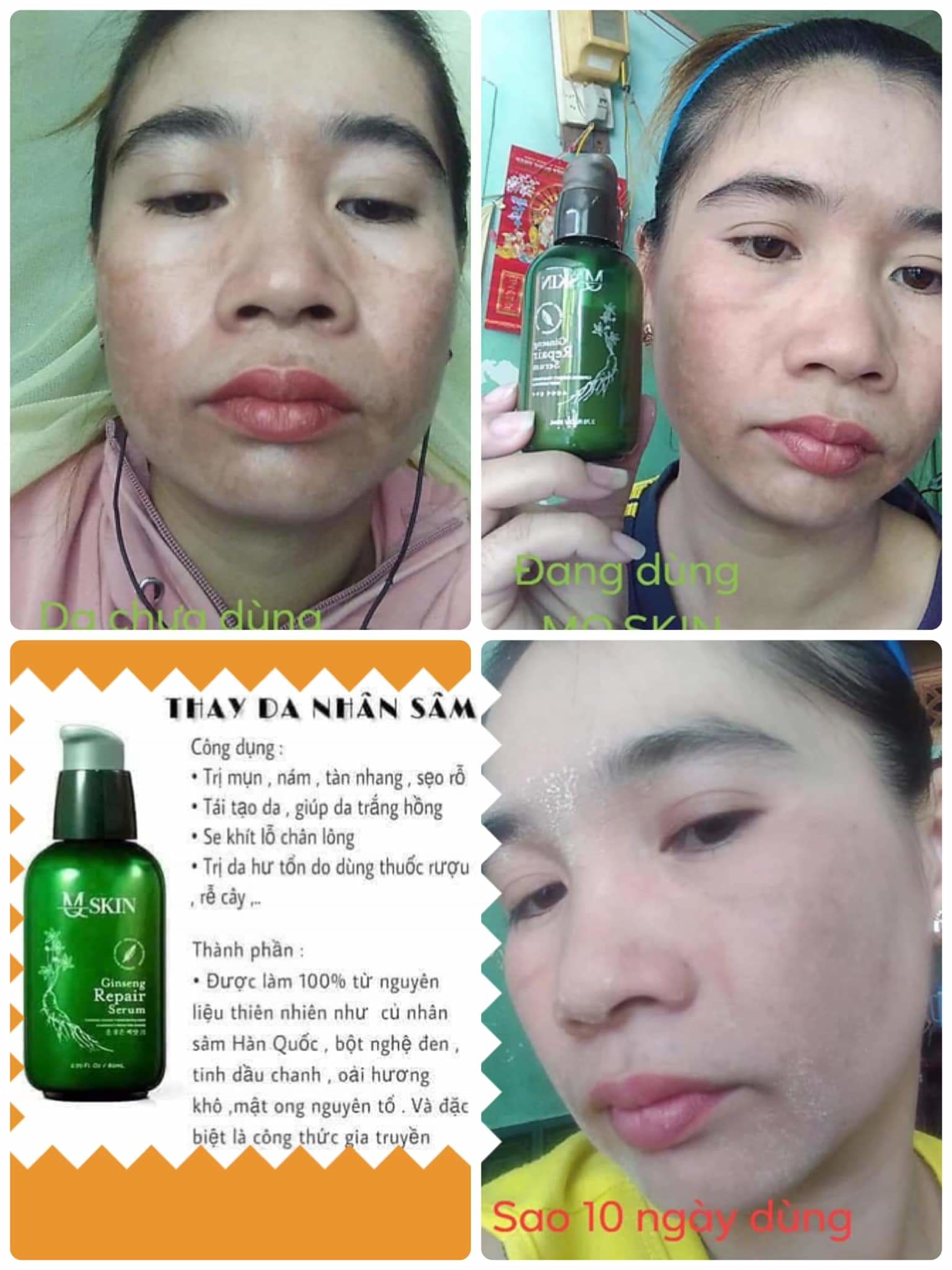 serum thay da nhân sâm mq skin