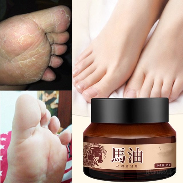 Kem Bôi Nẻ Ngựa L1