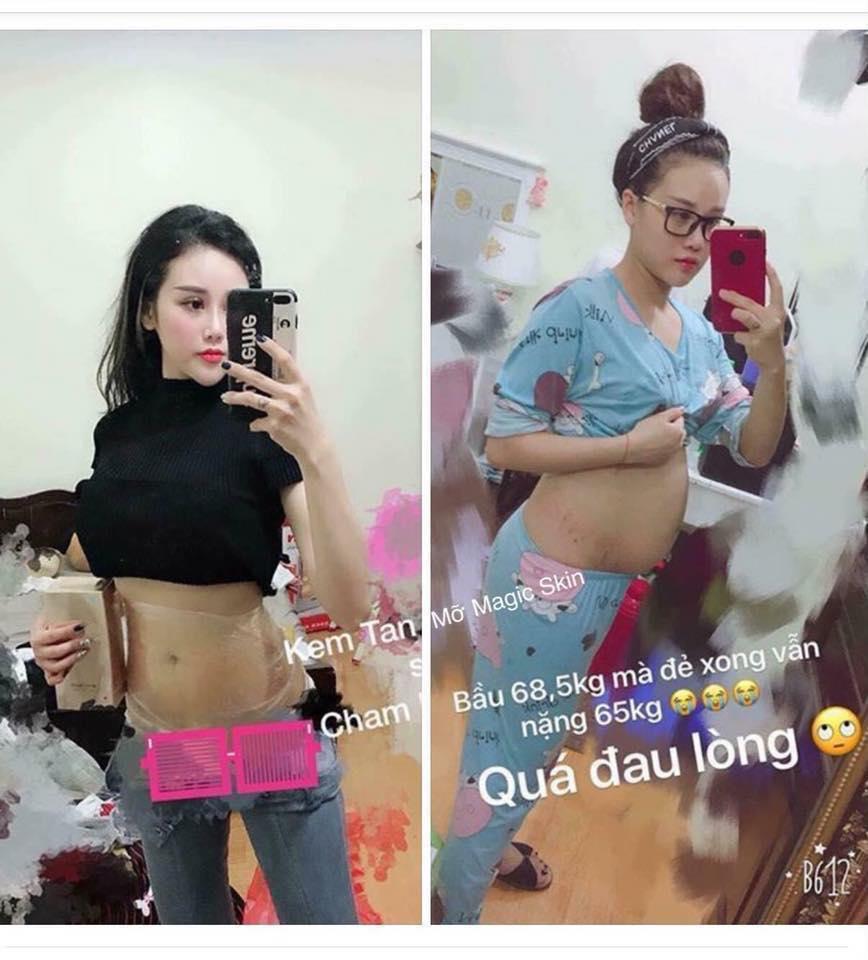 Kem Tan Mỡ Magic Skin