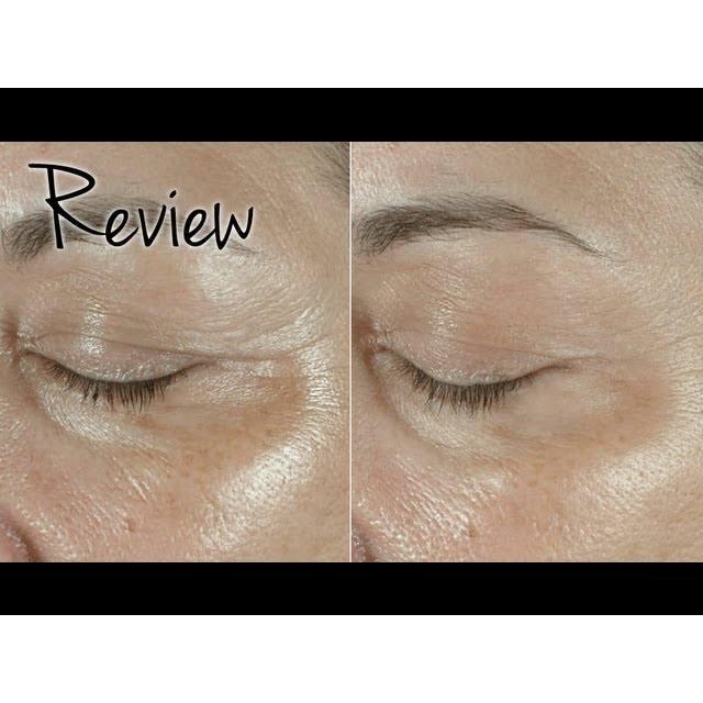 Serum Dưỡng Mắt Is Clinical Eye Complex