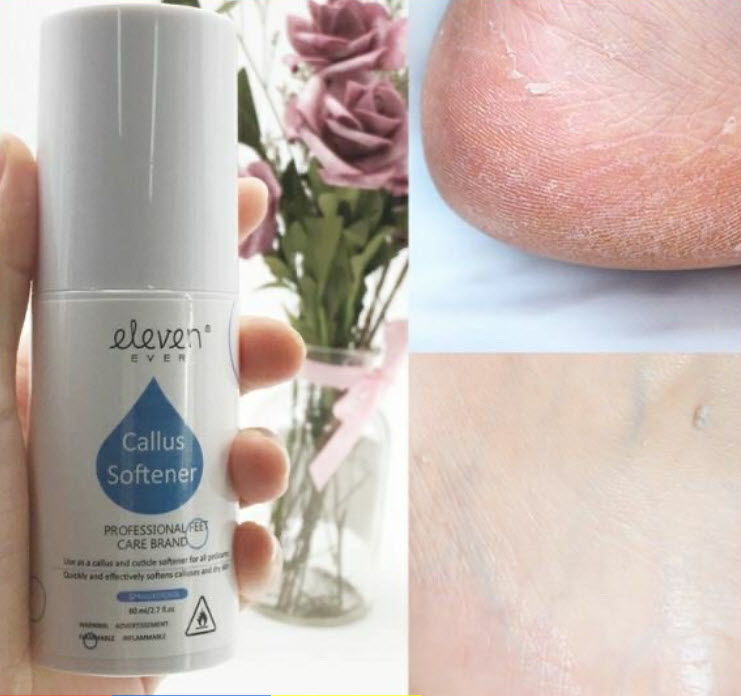 Chai Xịt, Nước Xịt Làm Mềm Da Chà Gót Chân Eleven (Sử dụng cùng Chà Gót Chân)