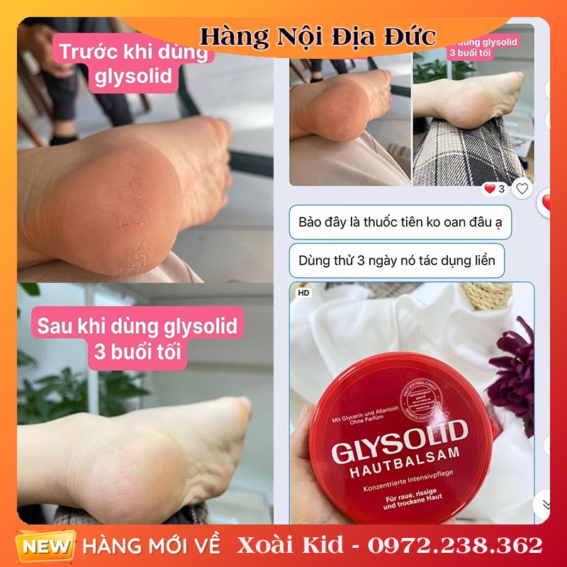 Kem dưỡng ẩm Glysolid Hautbalsam, 100 ml của Đức