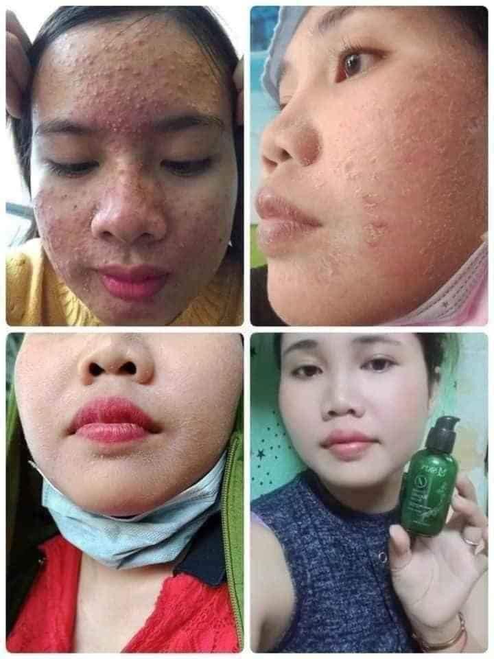 THAY DA NHÂN SÂM MQSKIN