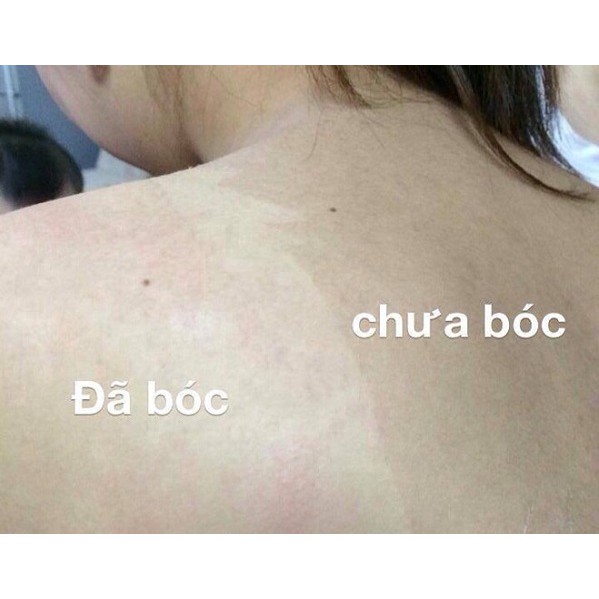 Lột da Collagen sinh học 100ml