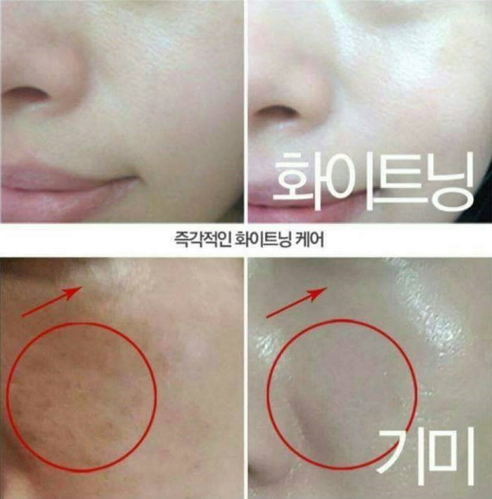 [HCM]Huyết Thanh Trắng Da 7day Whitening Program Glutathione 700 V-Ample