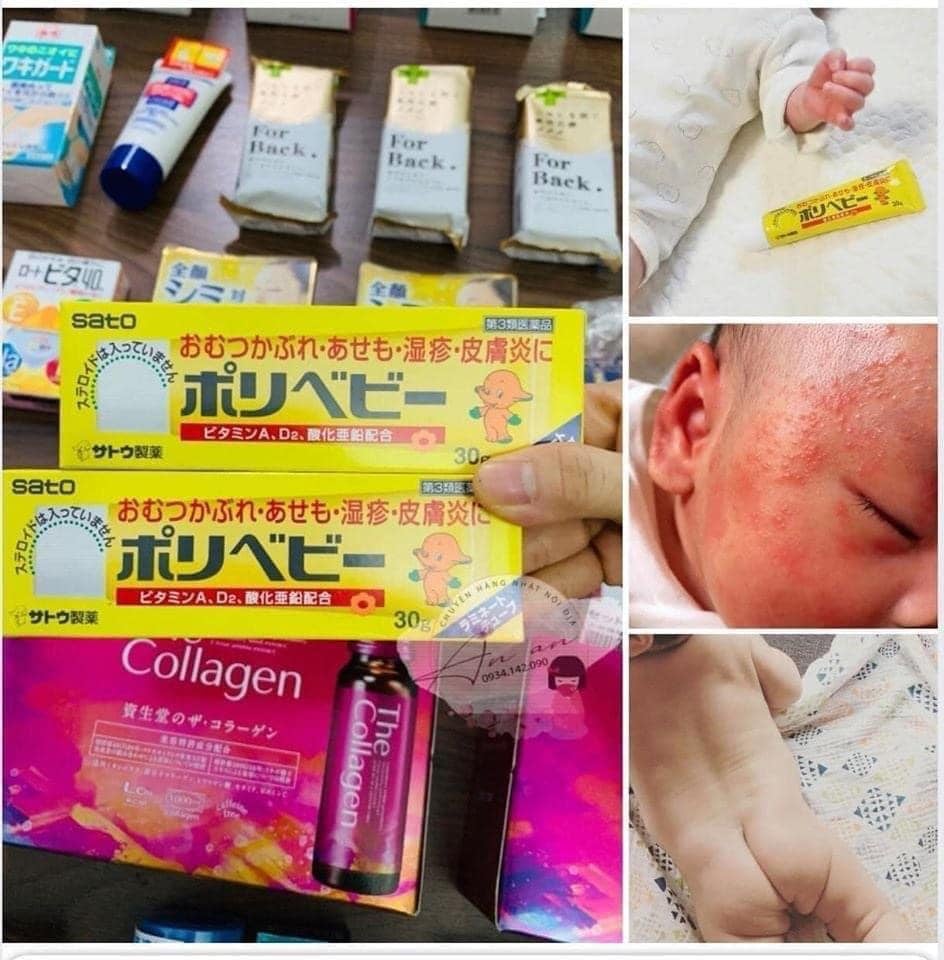Kem chống hăm Sato Polybaby 30g Nhật BảnCho bé từ 0 tháng tuổi