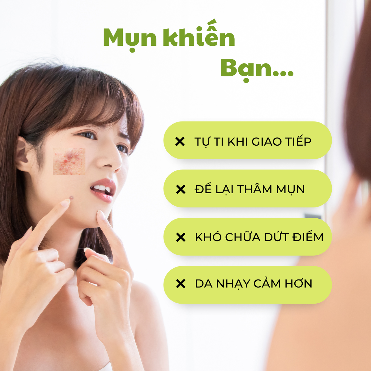 Chấm mụn, ngừa mụn Neem Acne Cream 20ml