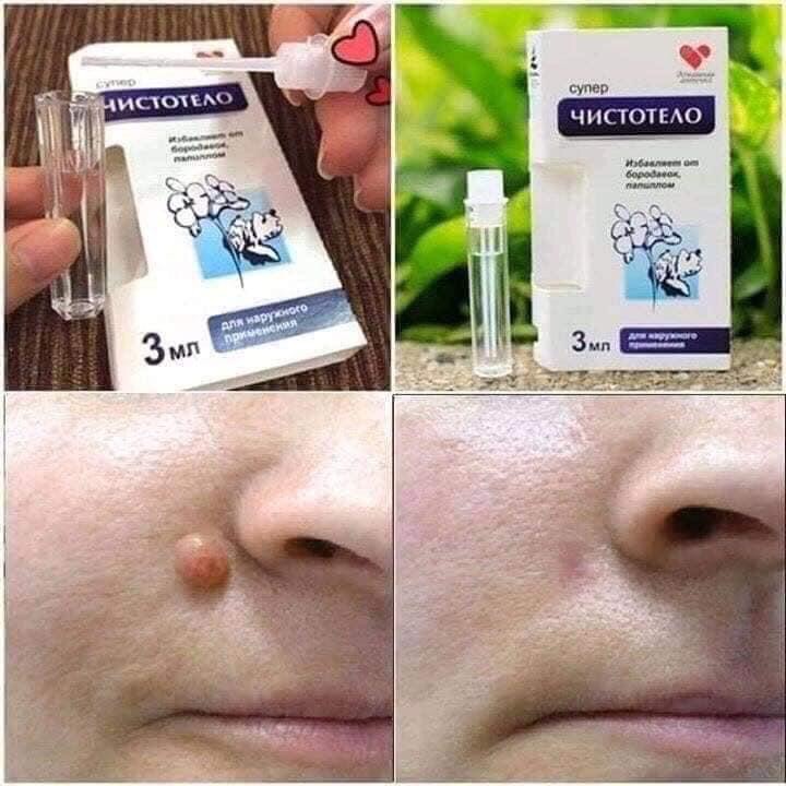 GEL TẨY NUỐT RUỒI NGA